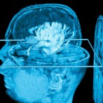 121113_4j40h_cerveau-examen-irm_sn635