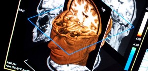 Brain-scan-by-Martin-Hieslmair-702x336