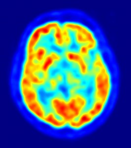 PET-image